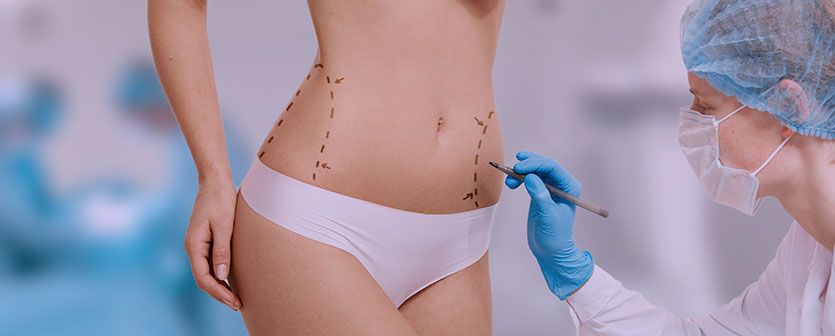 El liposonix reduce la grasa y estimula la producción de colágeno en la piel