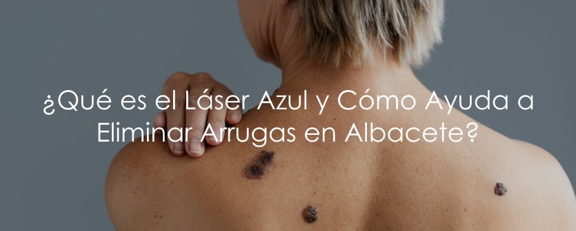 ¿Qué es el Láser Azul para Eliminar Arrugas y Cómo Funciona? – Tratamientos Estéticos en Albacete