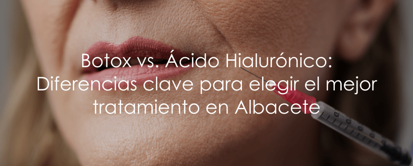 botox vs acido hialuronico en albacete cuales son los beneficios