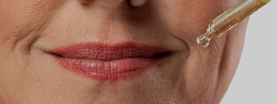beneficios del ácido hialurónico  y botox