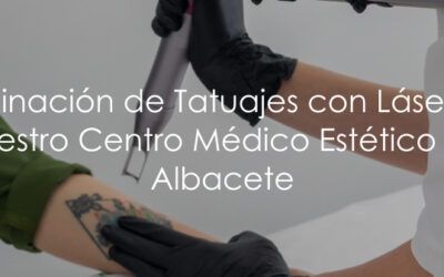 Eliminación de Tatuajes con Láser en Albacete Centro Médico Estético