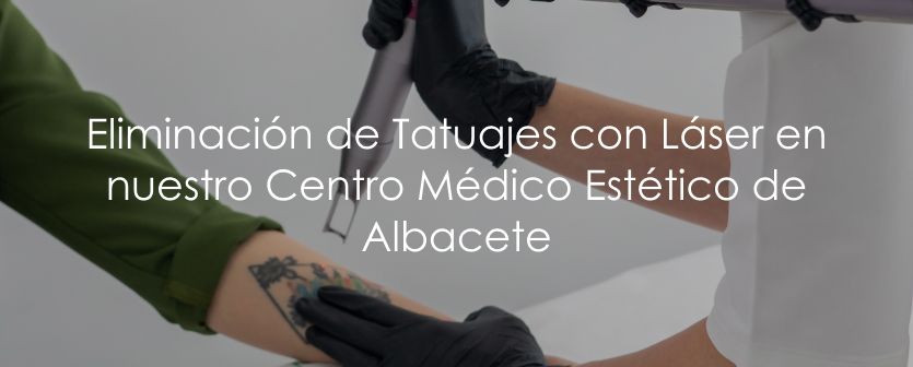 Eliminación de Tatuajes con Láser en Albacete Centro Médico Estético