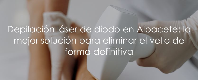 Depilación láser de diodo en Albacete: la mejor solución para eliminar el vello de forma definitiva